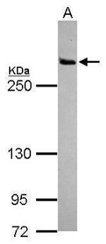 LRRK2 Antibody in Western Blot (WB)
