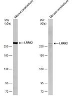 LRRK2 Antibody in Western Blot (WB)