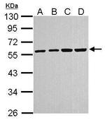 TUBA4A Antibody in Western Blot (WB)