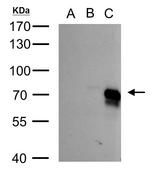 BMPR1A Polyclonal Antibody