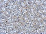 CEA Polyclonal Antibody