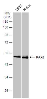 PAX6 Antibody in Western Blot (WB)