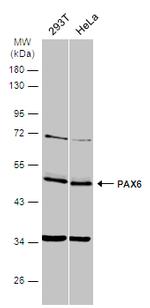 PAX6 Antibody in Western Blot (WB)