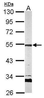 AP2M1 Polyclonal Antibody