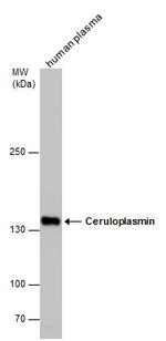 Ceruloplasmin Polyclonal Antibody