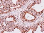 ERAB Polyclonal Antibody