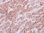 IDH3G Polyclonal Antibody