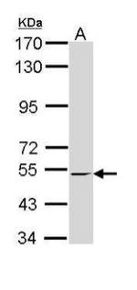 RXRB Antibody in Western Blot (WB)