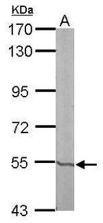 RXRB Antibody in Western Blot (WB)