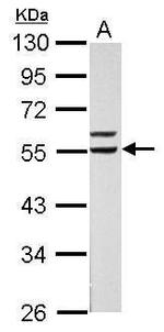 RXRA Polyclonal Antibody