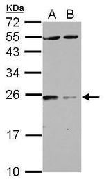14-3-3 zeta Polyclonal Antibody
