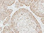 VDAC Polyclonal Antibody