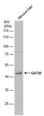 GATM Polyclonal Antibody