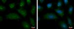 ENPP2 Polyclonal Antibody