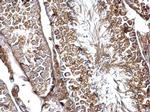 SH3GL3 Antibody in Immunohistochemistry (Paraffin) (IHC (P))
