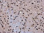 SMARCC2 Antibody in Immunohistochemistry (Paraffin) (IHC (P))