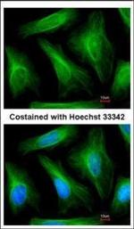 TUBA1A Polyclonal Antibody