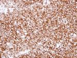 TUBA1A Antibody in Immunohistochemistry (Paraffin) (IHC (P))