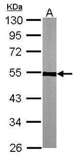 TUBA1A Antibody in Western Blot (WB)