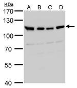 VDP Antibody in Western Blot (WB)