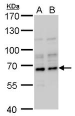 DUSP8 Antibody in Western Blot (WB)