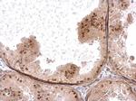 HELIOS Antibody in Immunohistochemistry (Paraffin) (IHC (P))