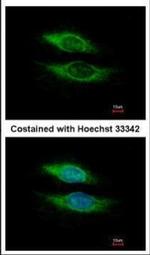 Nicastrin Antibody in Immunocytochemistry (ICC/IF)