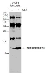 HBB Polyclonal Antibody