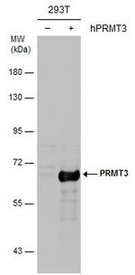 PRMT3 Polyclonal Antibody