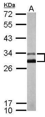 KChIP2 Polyclonal Antibody