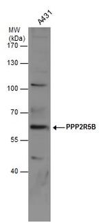 PPP2R5B Polyclonal Antibody