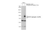 Phospho-STAT3 (Tyr705) Antibody in Western Blot (WB)