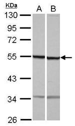 beta Tubulin Polyclonal Antibody