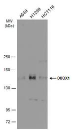 DUOX1 Antibody in Western Blot (WB)