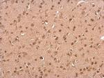 C9orf72 Antibody in Immunohistochemistry (Paraffin) (IHC (P))