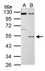 C9orf72 Antibody in Western Blot (WB)