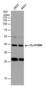 AAGAB Antibody in Western Blot (WB)