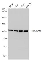 UFL1 Polyclonal Antibody