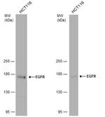 EGFR Antibody in Western Blot (WB)