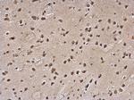 SLUG Polyclonal Antibody