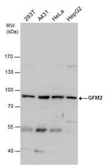 GFM2 Polyclonal Antibody