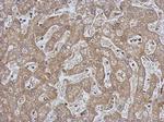 CPEB1 Polyclonal Antibody