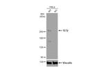TET2 Antibody in Western Blot (WB)