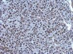 TET1 Antibody in Immunohistochemistry (Paraffin) (IHC (P))