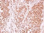 TET1 Antibody in Immunohistochemistry (Paraffin) (IHC (P))