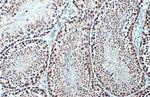 TET1 Antibody in Immunohistochemistry (Paraffin) (IHC (P))