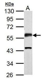Phospho-CaMKII alpha (Thr286) Antibody in Western Blot (WB)