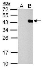 PITX2 Polyclonal Antibody