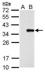 COL11A2 Polyclonal Antibody