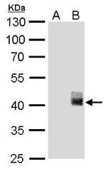 BABAM1 Antibody in Western Blot (WB)